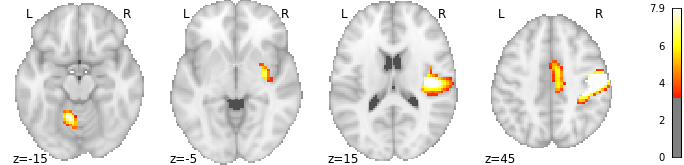 /img/combining-nilearn-plots/fig1.png